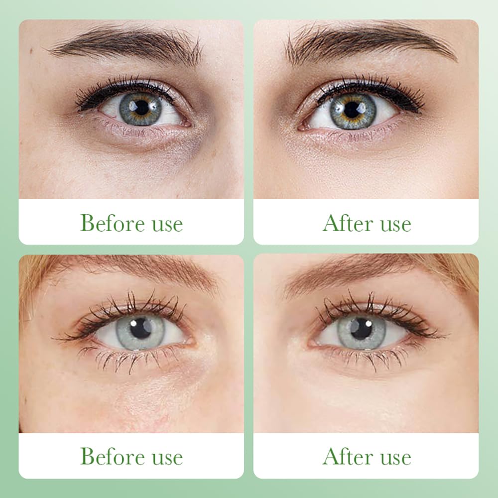 Aloe Vera Eye Masks - 60 PCS Under Eye Patches for Puffiness & Dark Circle, Moisturizing Firming Eyes Gel Pad Patches for Bag Puffiness Daily Skincare, Gifts for Women