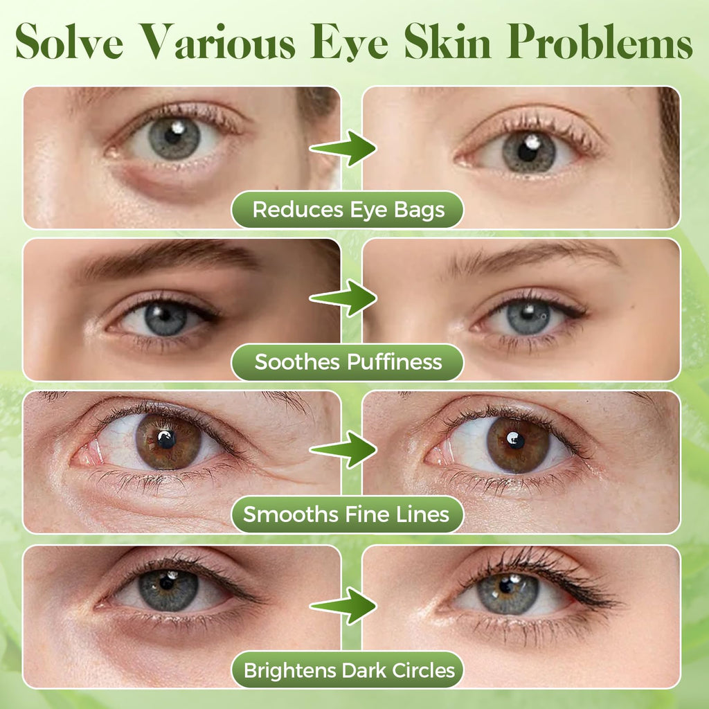 Aloe Vera Under Eye Patches for Dark Circles, Puffiness Relief, Hydrating Hydrogel Mask, Moisturizing Gel Pads for Bags and Tired Skin