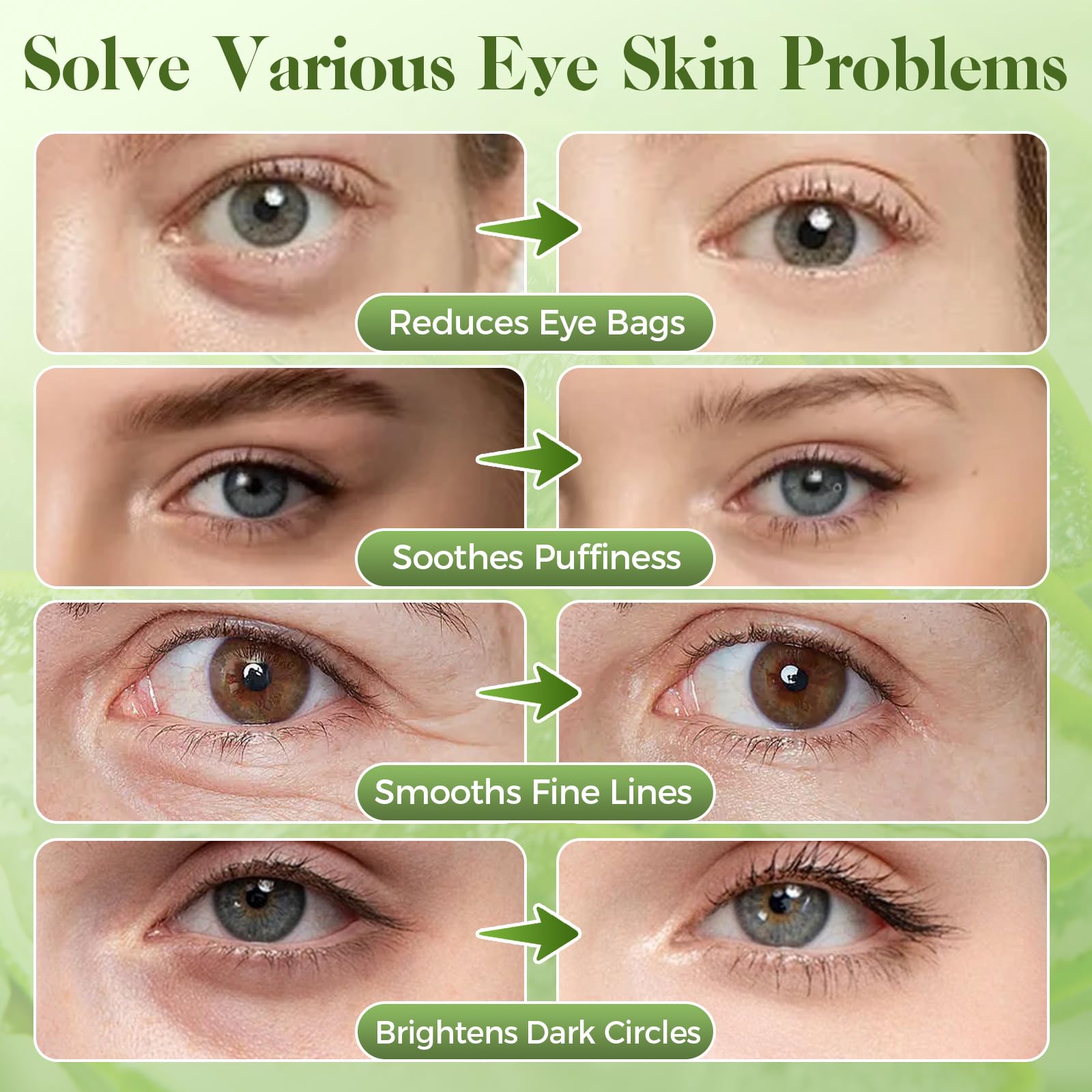 Aloe Vera Under Eye Patches for Dark Circles, Puffiness Relief, Hydrating Hydrogel Mask, Moisturizing Gel Pads for Bags and Tired Skin