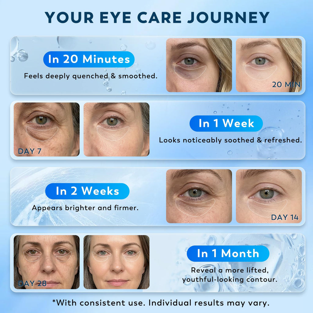Retinol Collagen Under Eye Patches for Men & Women 30 Pairs | Hydrogel Eye Masks for Dark Circles, Wrinkles & Firming - Hydrating Anti-Aging Gel Pads