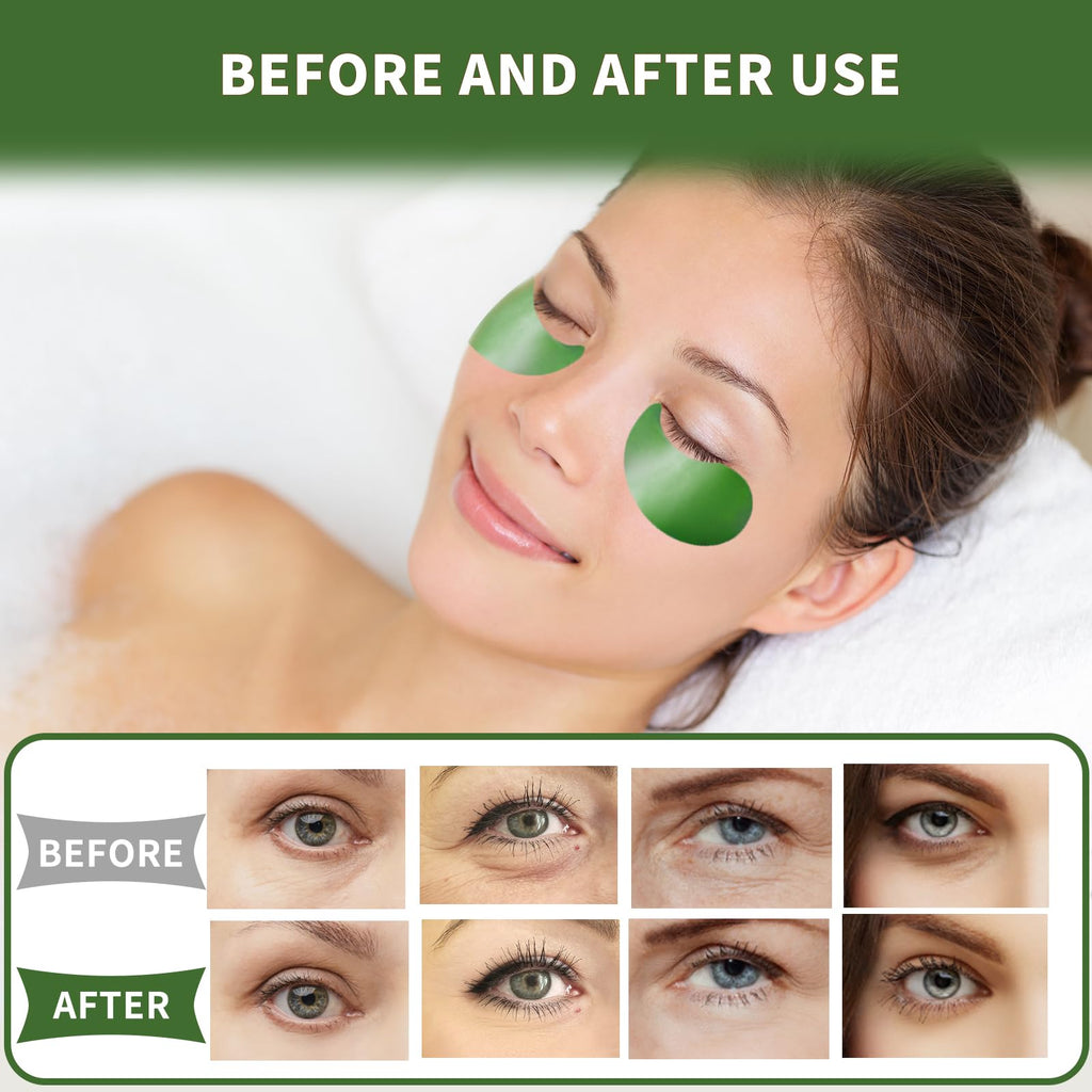 Qyiywim Under Eye Patches 70PCS, 24K Gold Eye Patches for Puffy Eyes Treatment, Under Eye Masks for Dark Circles and Puffiness, Non-Irritating Eye Mask Skincare, Eyes Bags Treatment, Eye Gel Pads